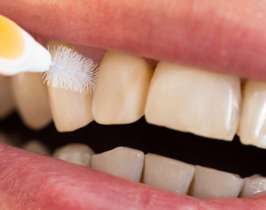 Cleaning between teeth: the secret behind a healthy smile- treatment at gardencity  